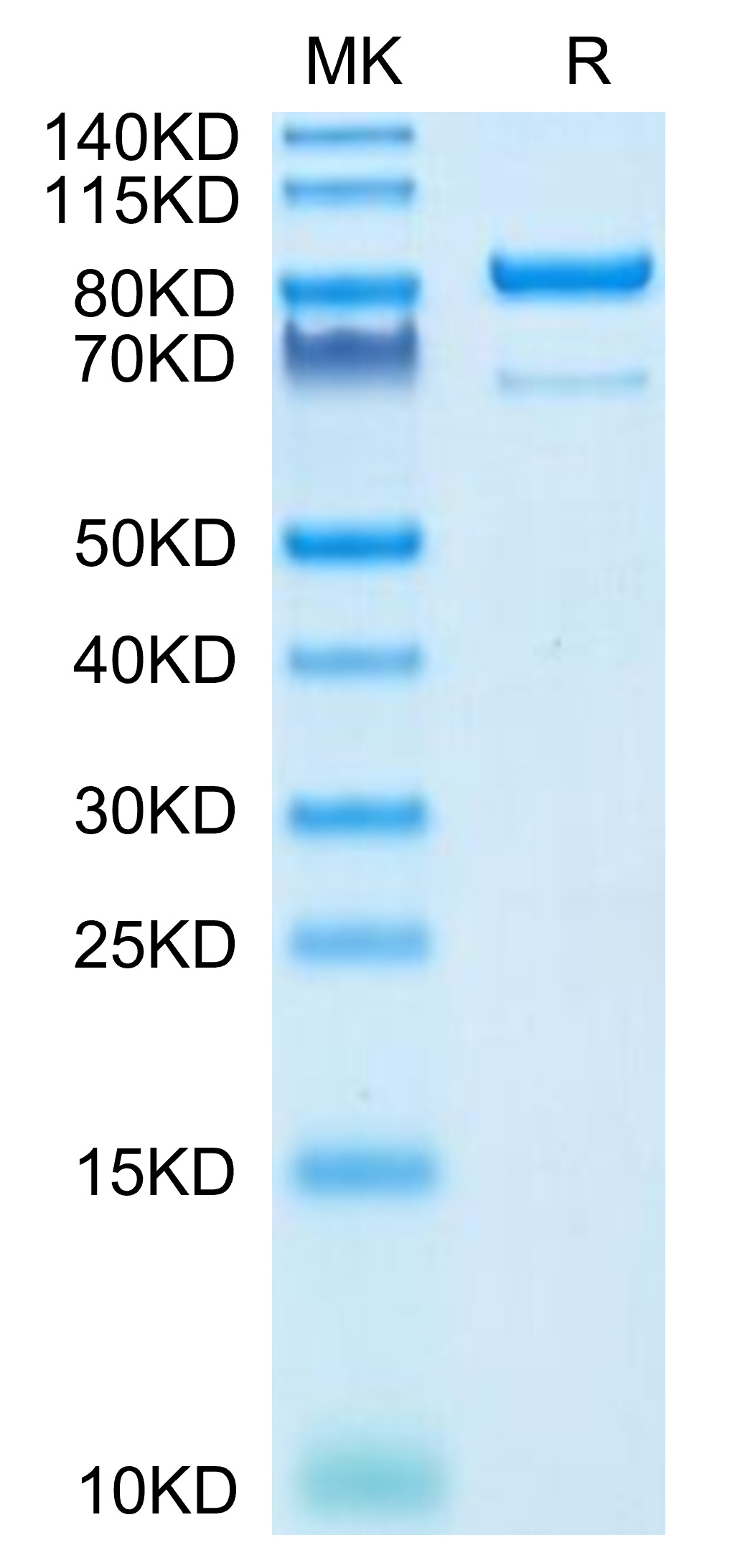 Recombinant Human 5'-Nucleotidase/NT5E/CD73 Protein