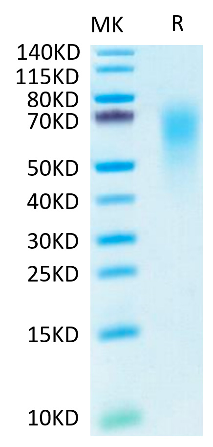 Recombinant Human CEACAM6/CD66c Protein