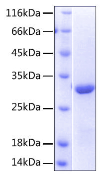 Recombinant Human NKG2-D/KLRK1/CD314 Protein