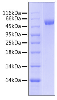 Recombinant Human Lipopolysaccharide-binding protein/LBP Protein