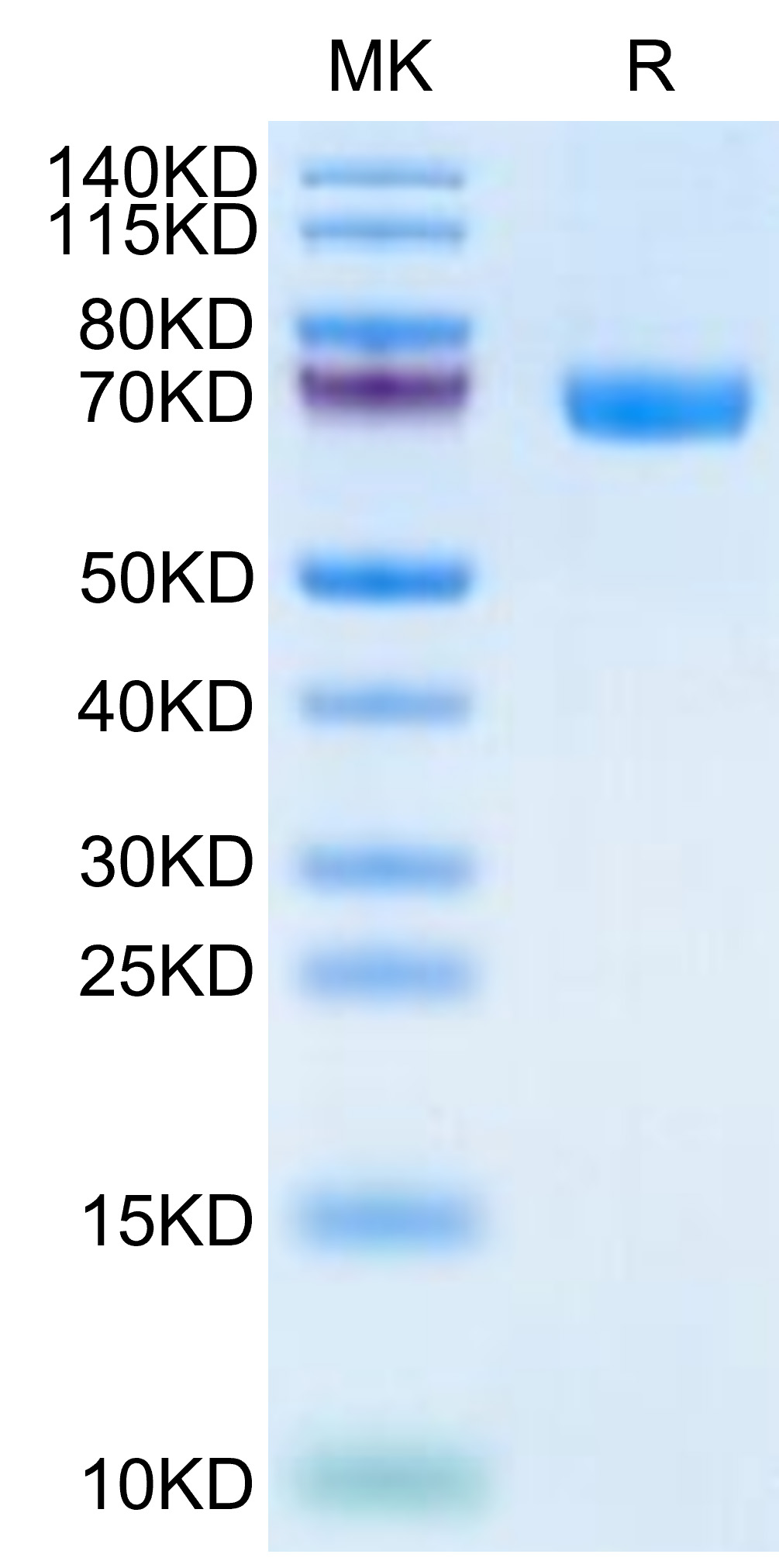 Recombinant Human TROP-2/TACSTD2 Protein