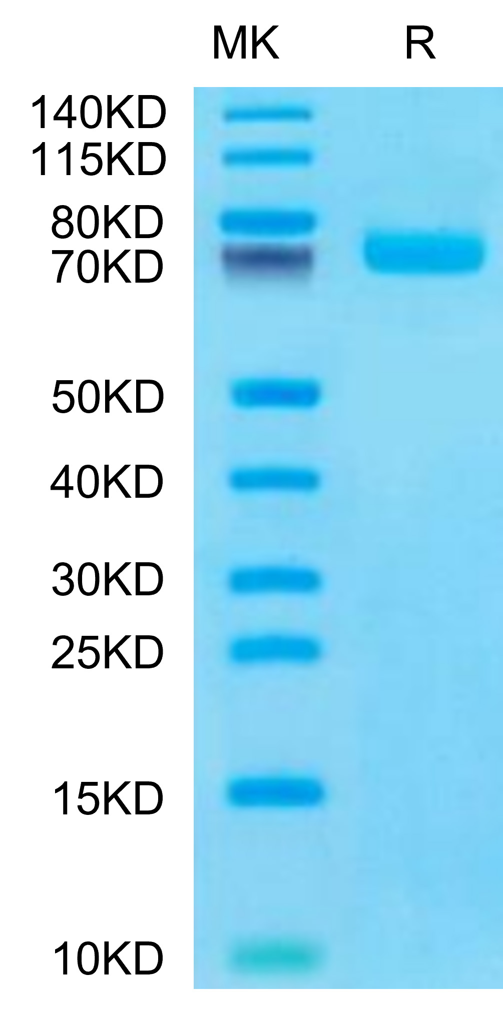 Recombinant Human BCAM/CD239 Protein