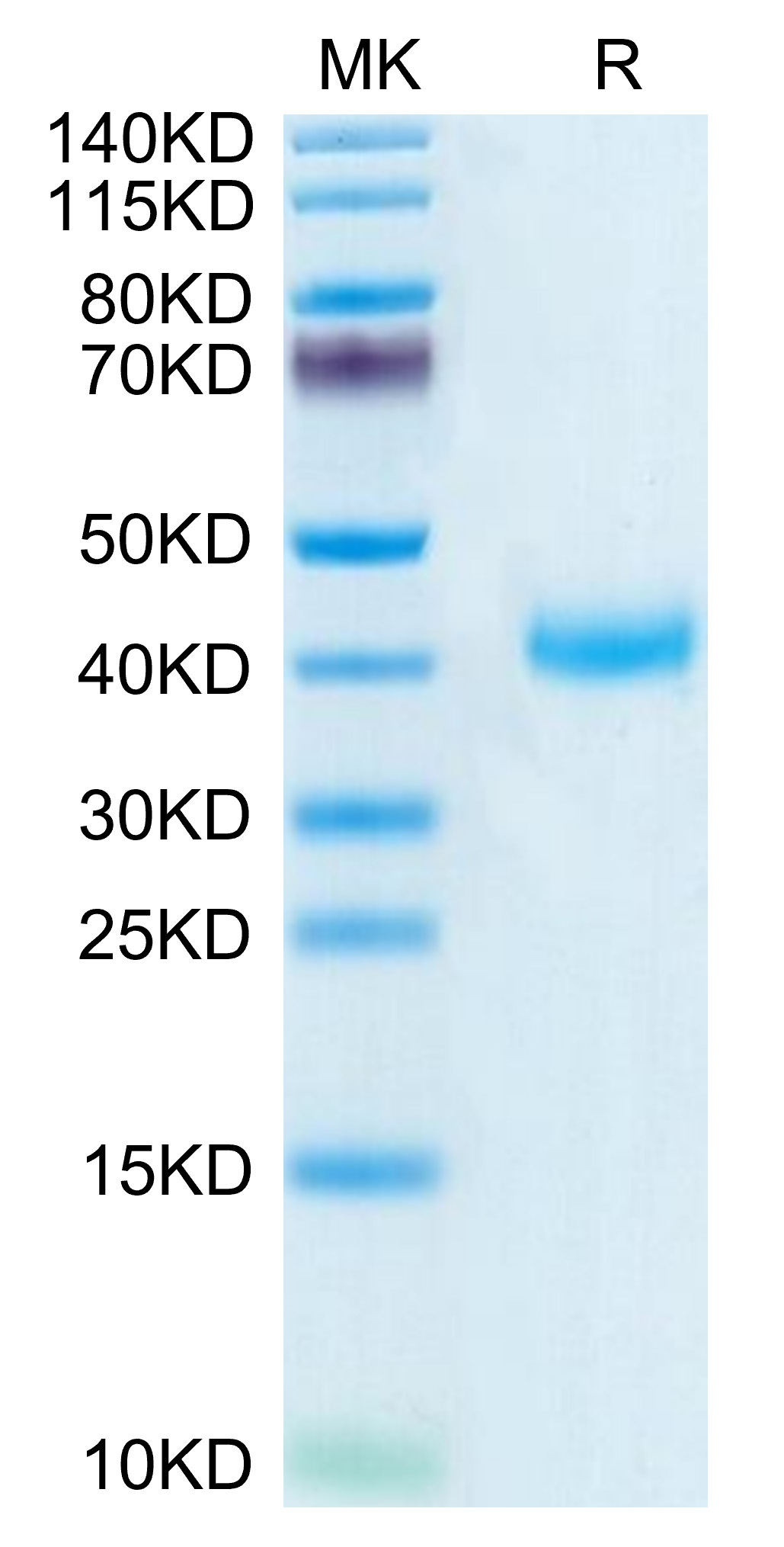 Biotinylated Recombinant Human KLRB1/CD161 Protein