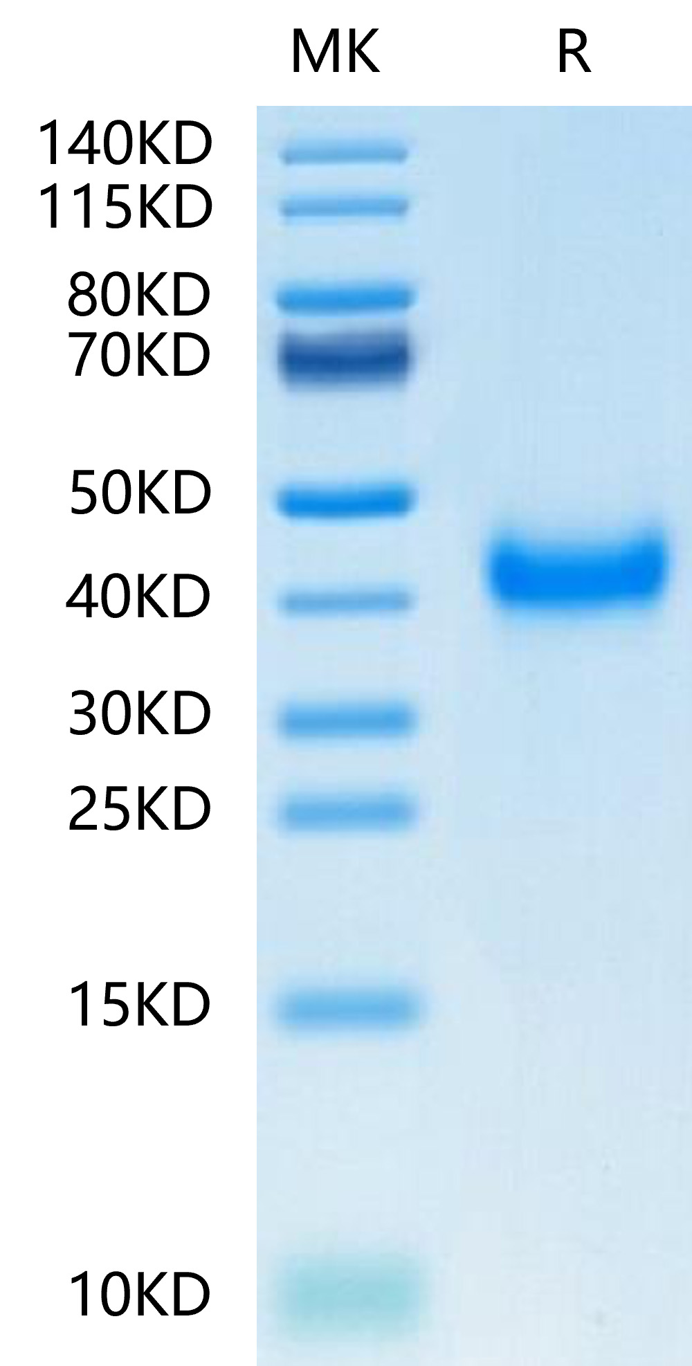 Recombinant Human KLRB1/CD161 Protein