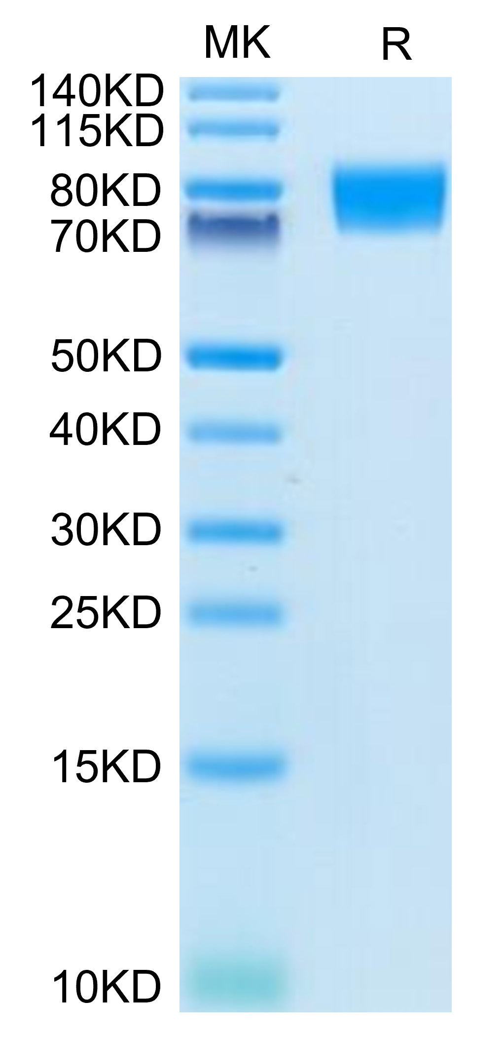 Recombinant Human c-Kit/CD117 Protein