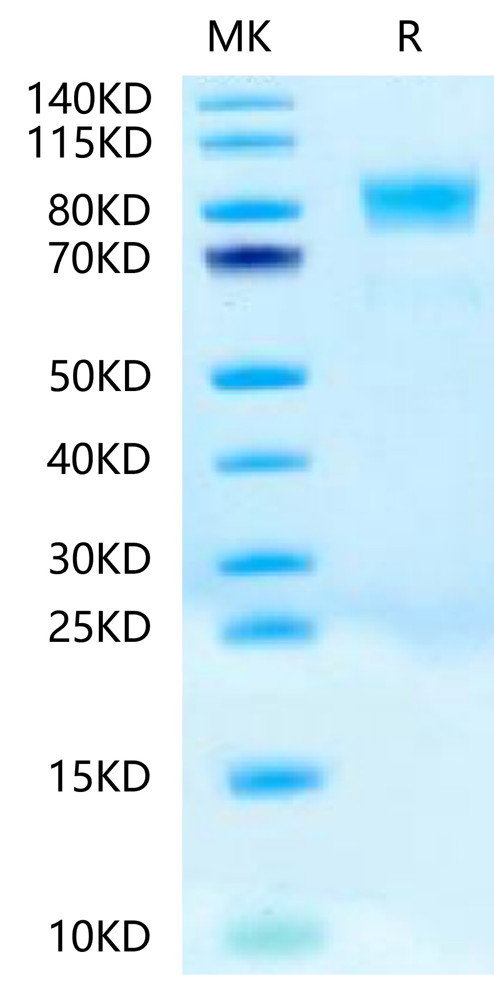 Biotinylated Recombinant Human c-Kit/CD117 Protein