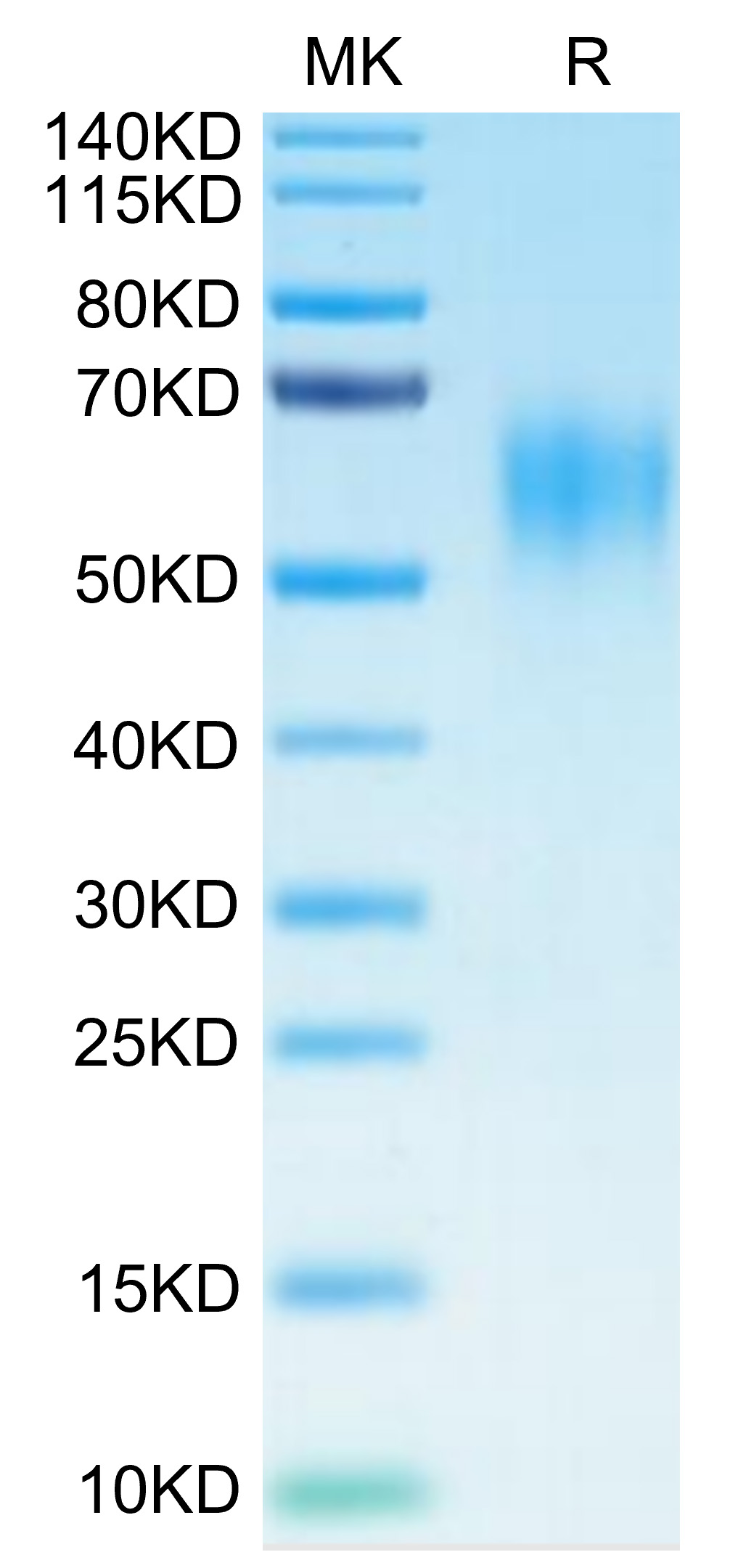 Recombinant Human IL-15RA/CD215 Protein