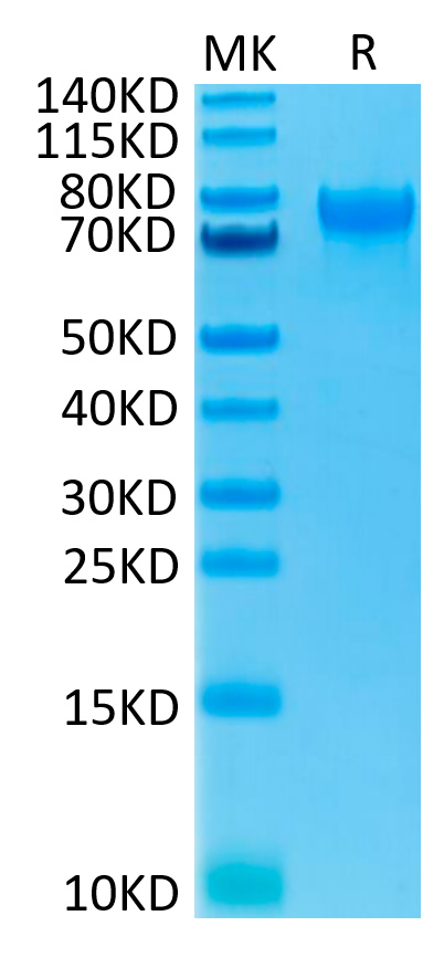 Recombinant Human IL-15RA/CD215 Protein