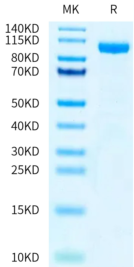 Recombinant Human IL-12 R beta 1/CD212 Protein