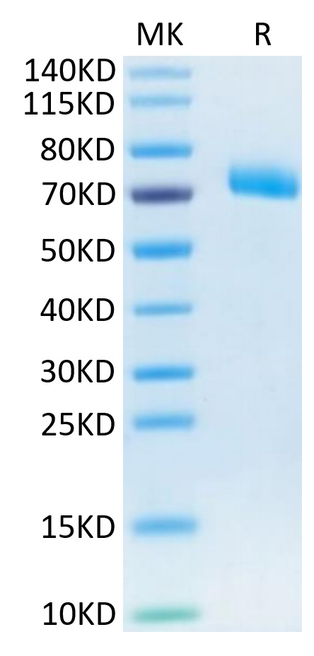 Recombinant Human IL-12 R beta 1/CD212 Protein