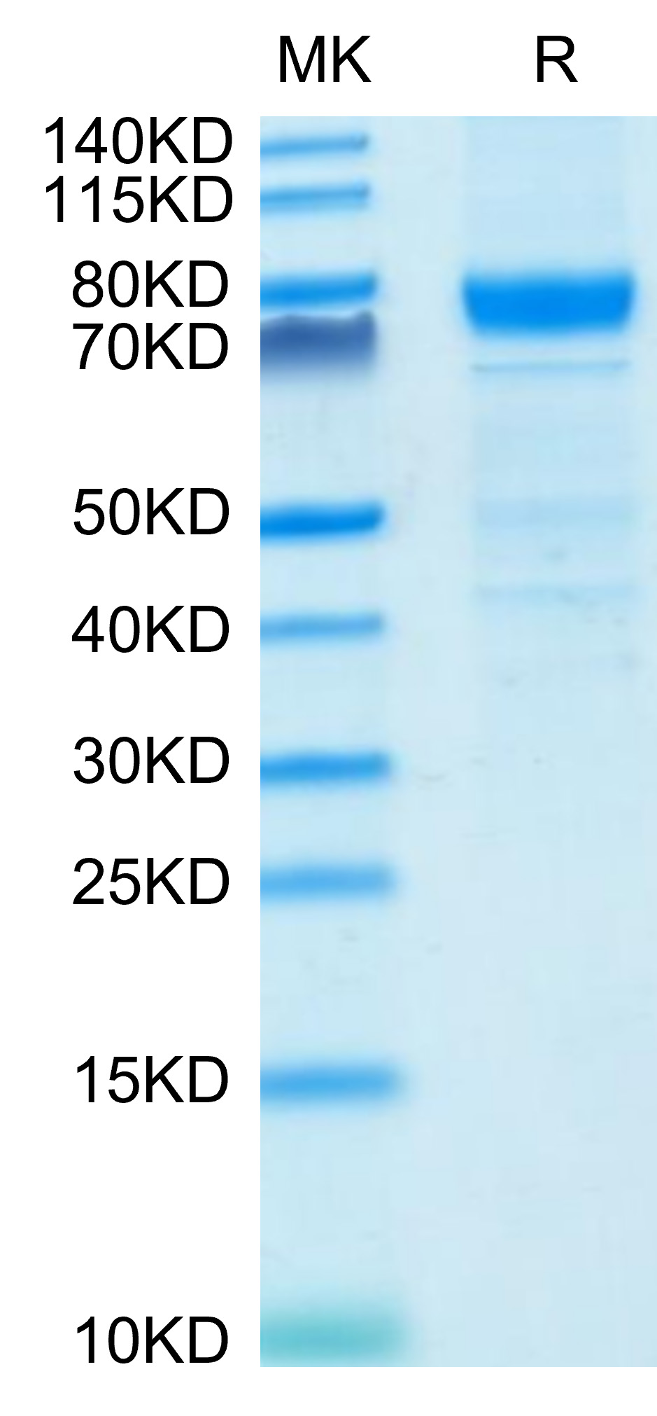 Recombinant Human IL-3RA/CD123 Protein