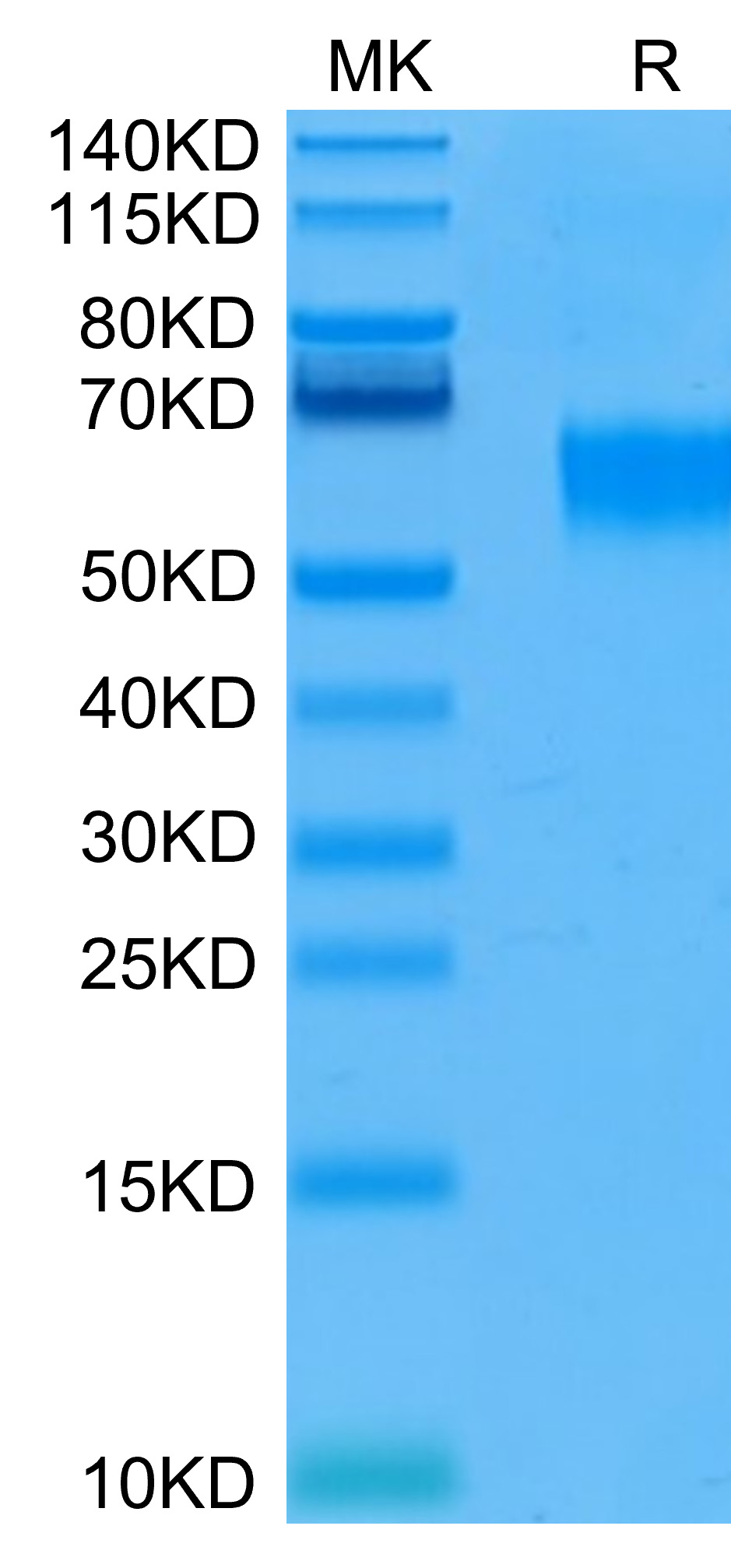 Recombinant Human IL-3RA/CD123 Protein