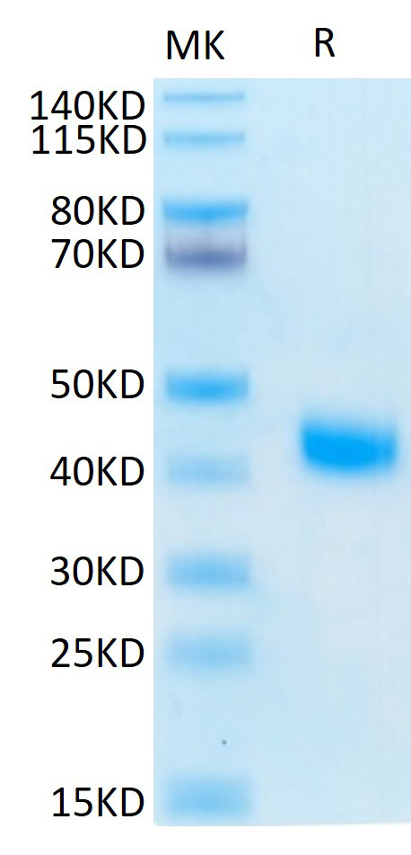 Recombinant Human IL-2 R beta/CD122 Protein