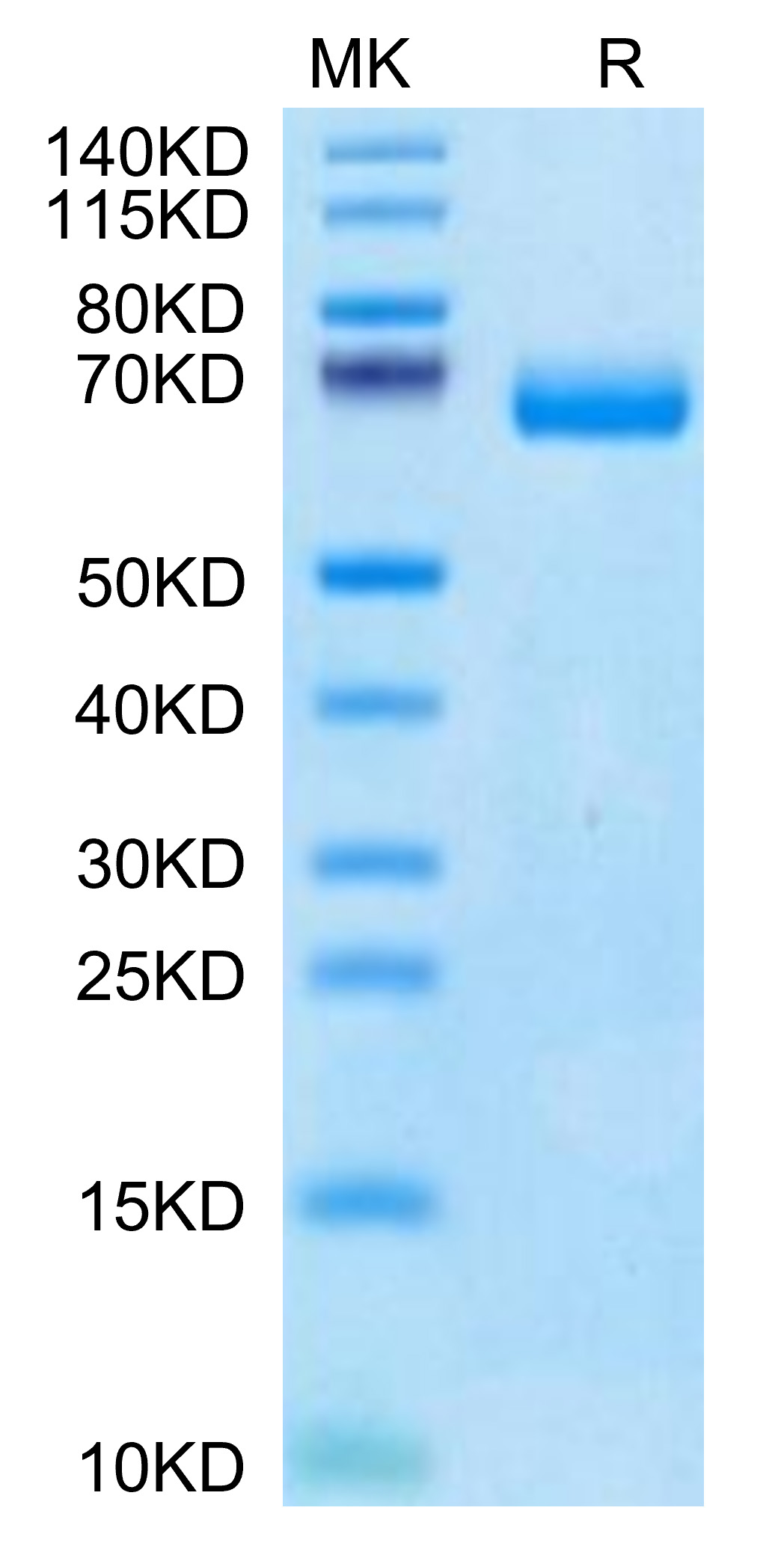 Recombinant Human IL-2 R beta/CD122 Protein