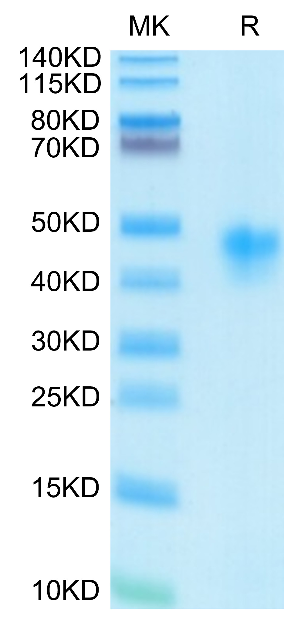 Recombinant Human IL-2 R alpha/CD25 Protein