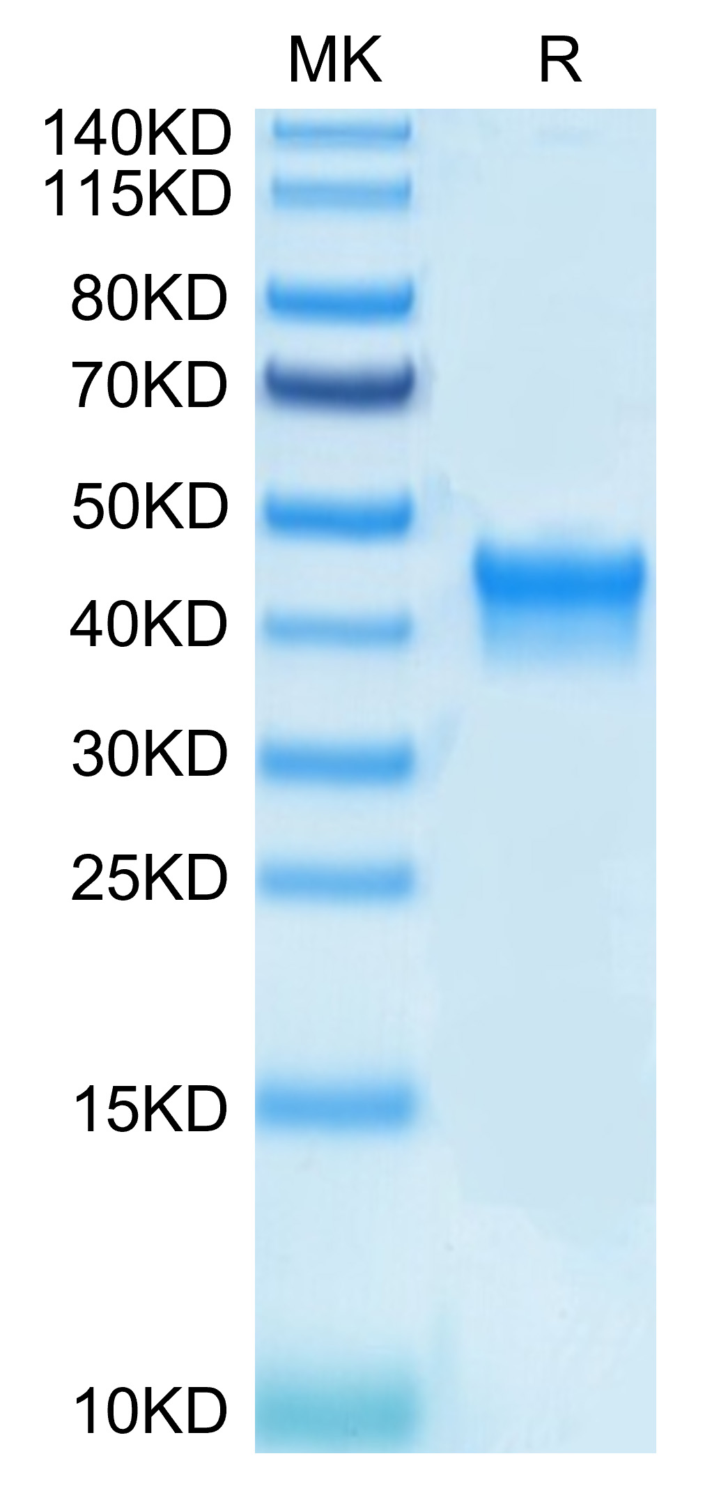 Biotinylated Recombinant Human IL-2 R alpha/CD25 Protein