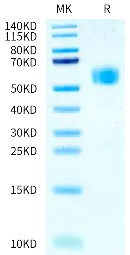 Recombinant Human IL-1R1/CD121a Protein