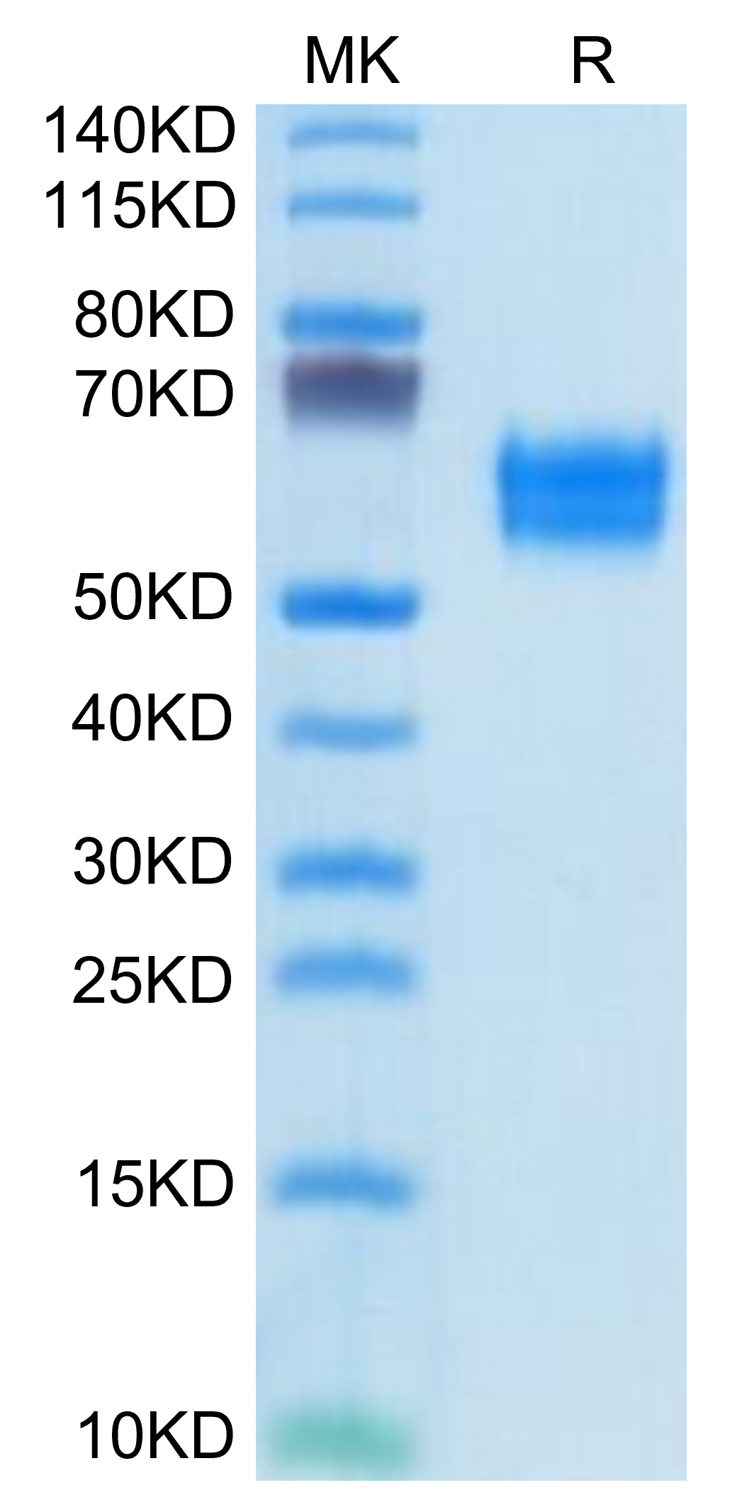 Recombinant Human IL-1R1/CD121a Protein