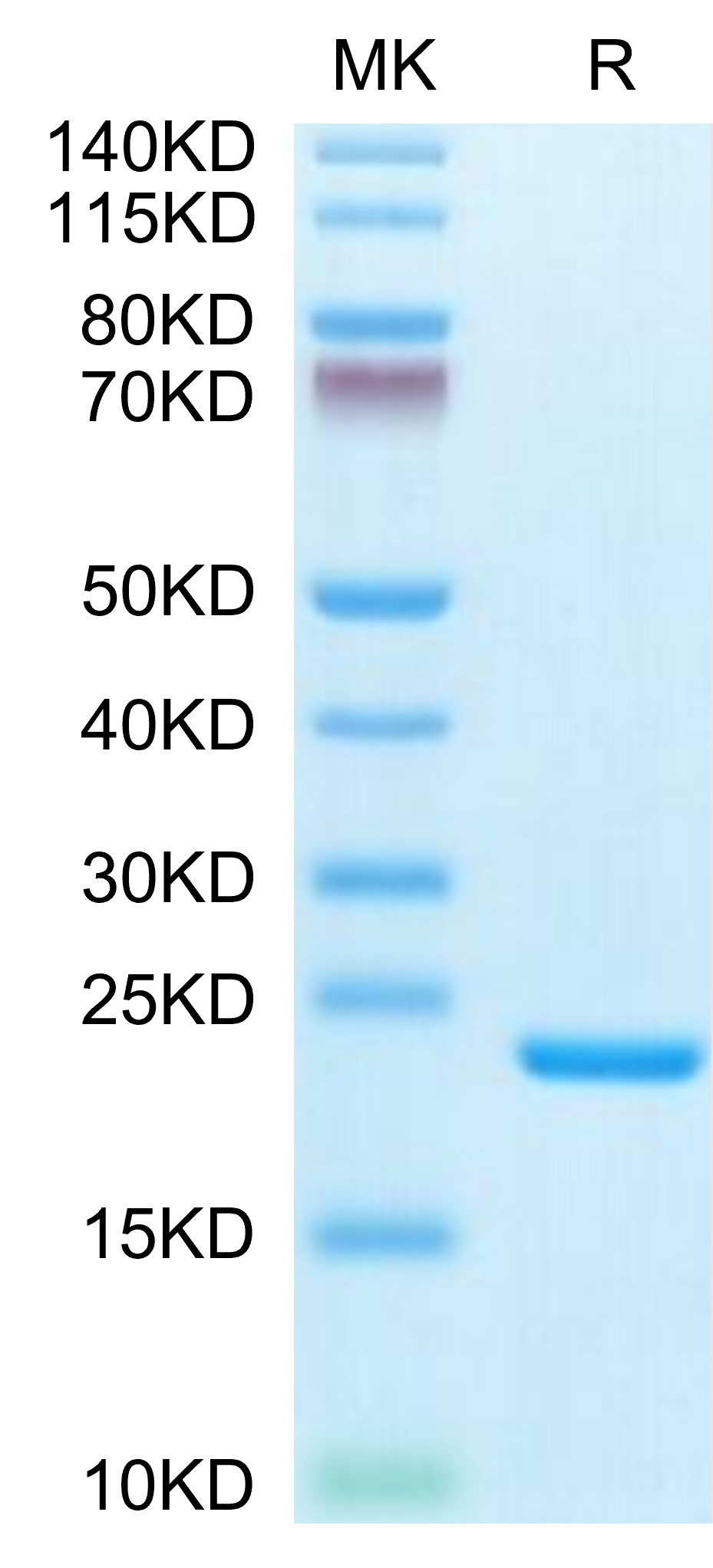 Biotinylated Recombinant Human IL-1 beta Protein