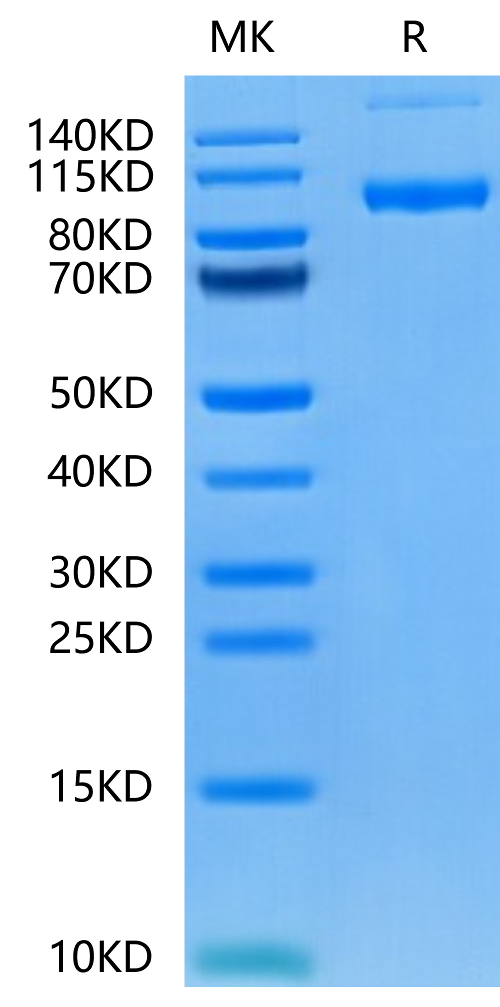 Recombinant Human PSMA/FOLH1 Protein