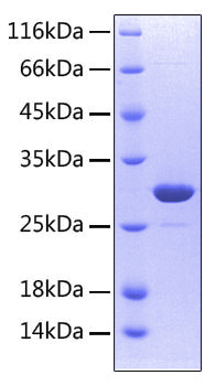 Recombinant Human TNFRSF11A/RANK/CD265 Protein