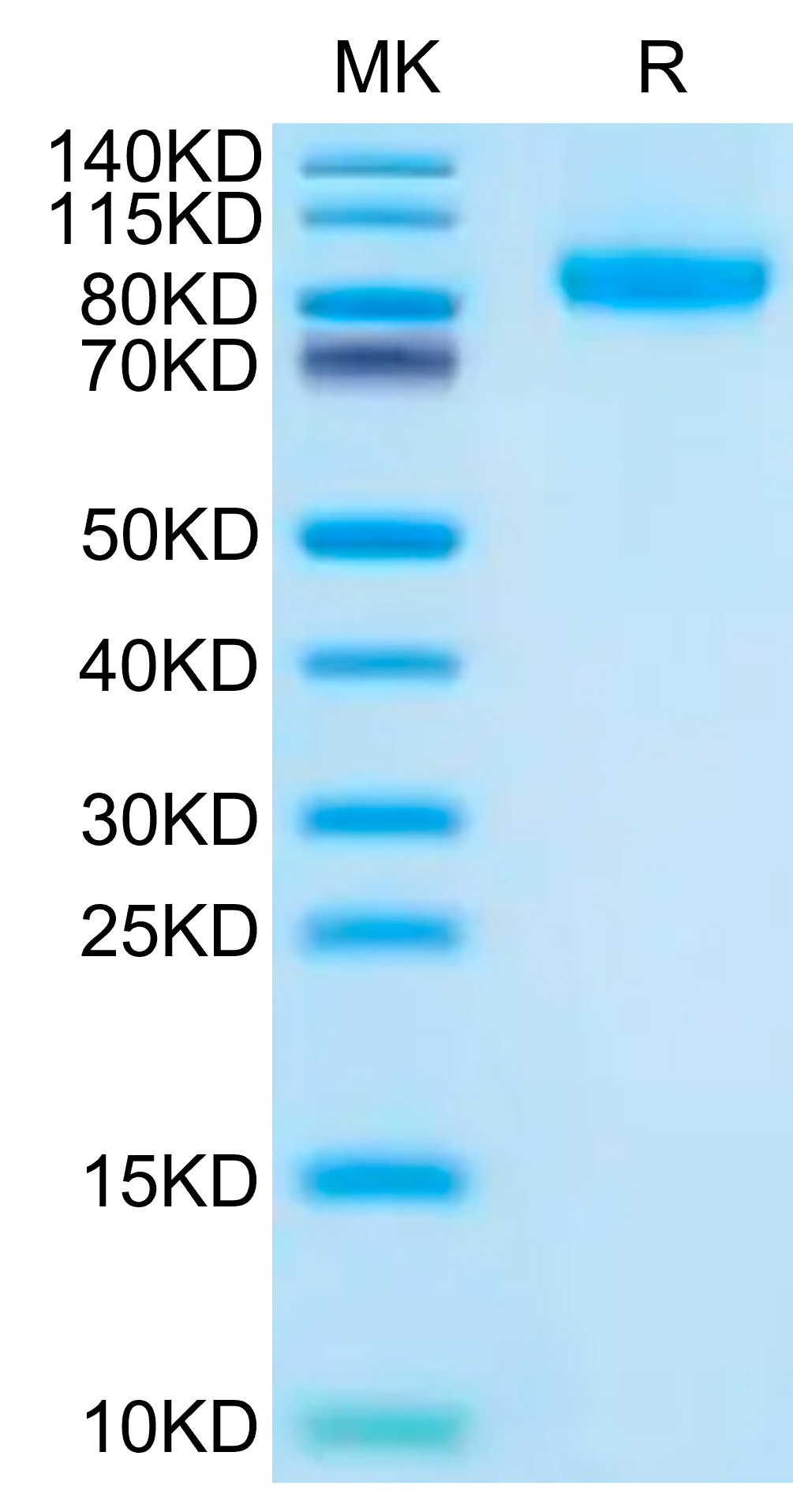 Recombinant Human FLT-3/FLK-2/CD135 Protein