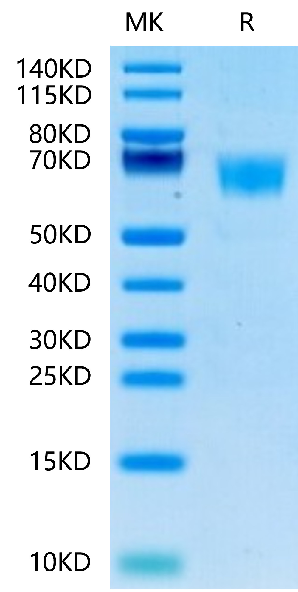 Recombinant Human FGFR-3 alpha (IIIc)/CD333 Protein