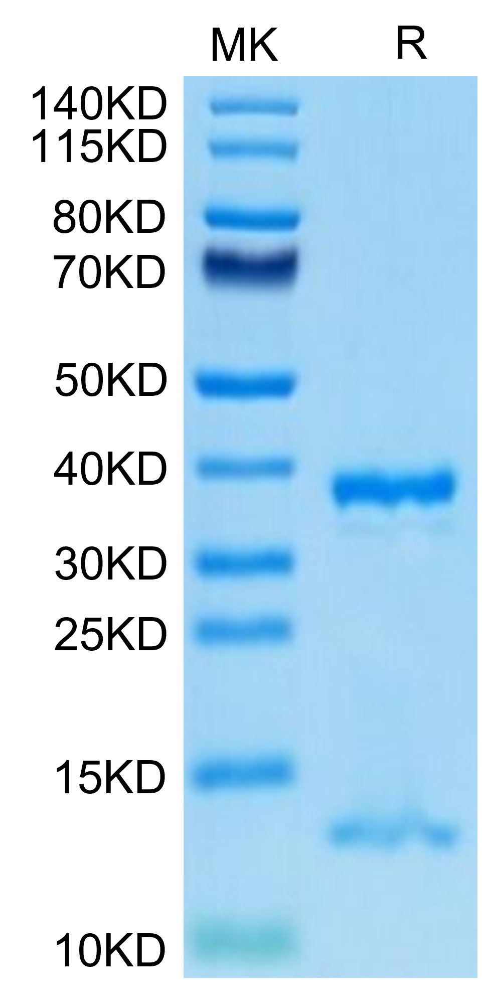 Recombinant Human FcRn/FCGRT&B2M Protein