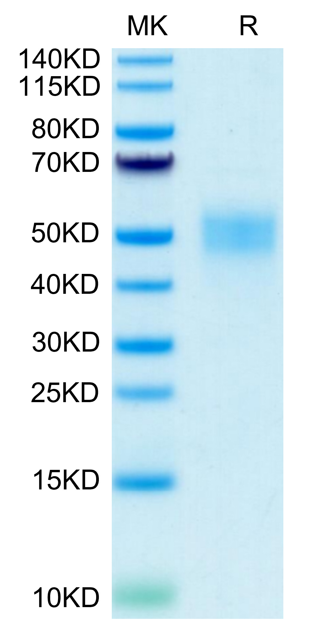 Recombinant Human Fc-gamma RIII beta/FCGR3B/CD16b Protein