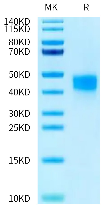 Recombinant Human Fc-gamma RIII beta/FCGR3B/CD16b (S36R, N82D, I106V) Protein