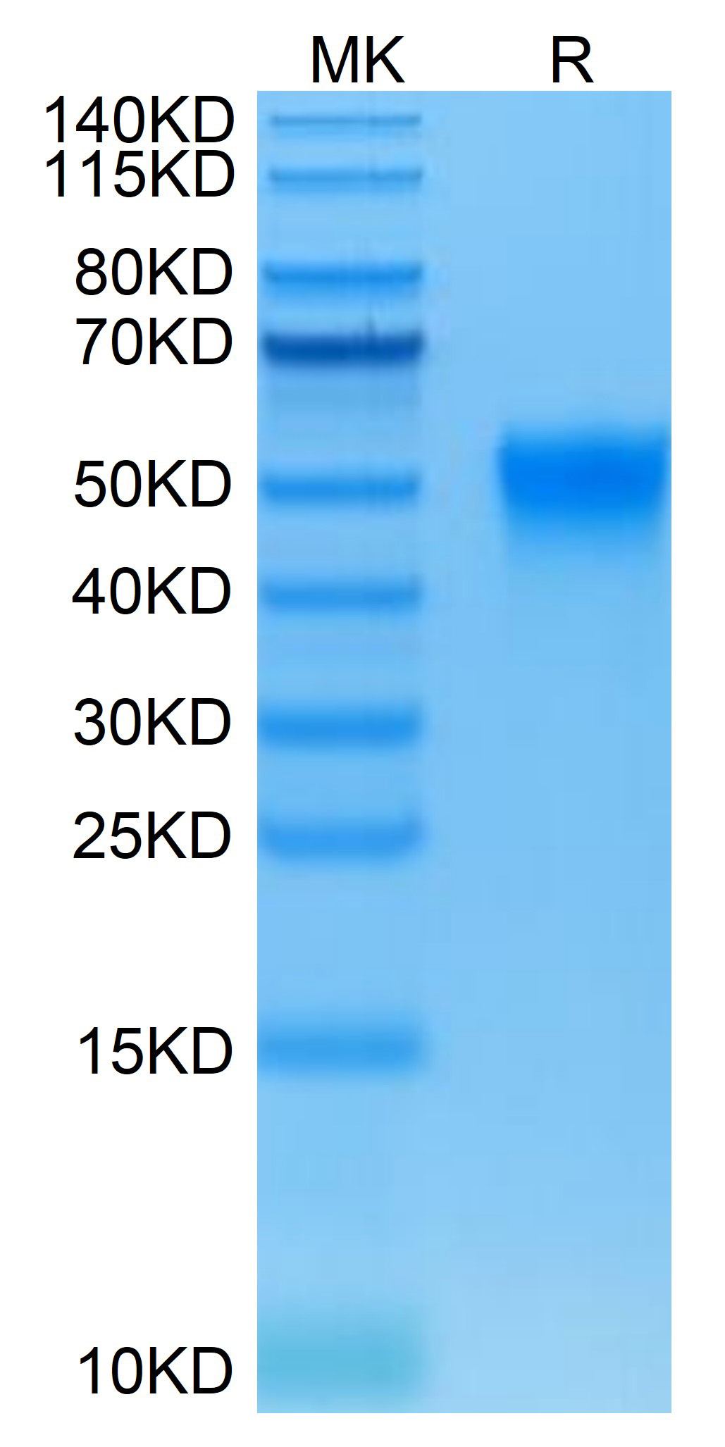 Biotinylated Recombinant Human Fc-gamma RIII alpha/FCGR3A/CD16a Protein