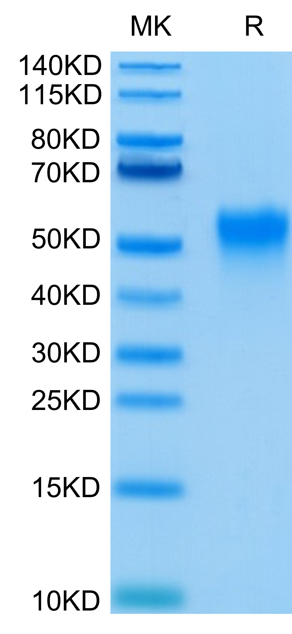 Recombinant Human Fc-gamma RIII alpha/FCGR3A/CD16a (F176V) Protein