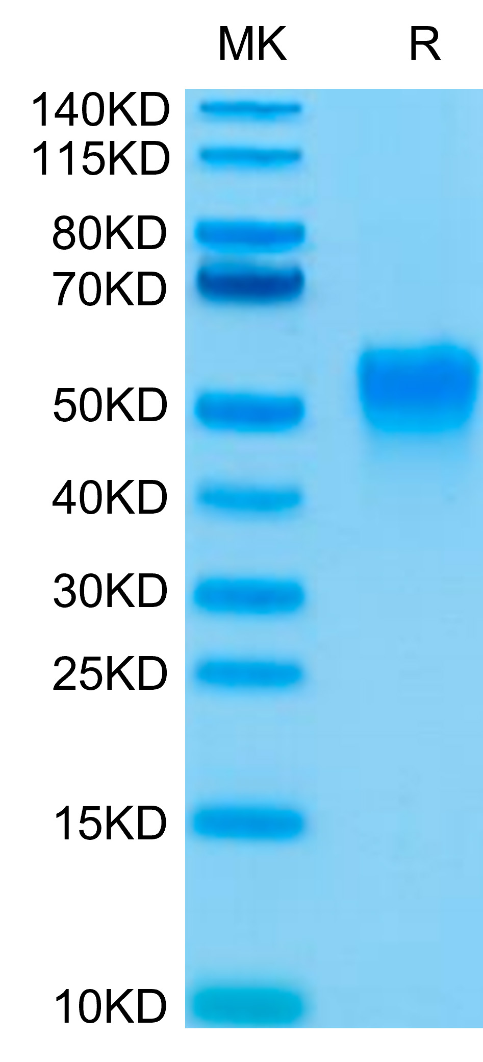 Biotinylated Recombinant Human Fc-gamma RIII alpha/FCGR3A/CD16a (F176V) Protein