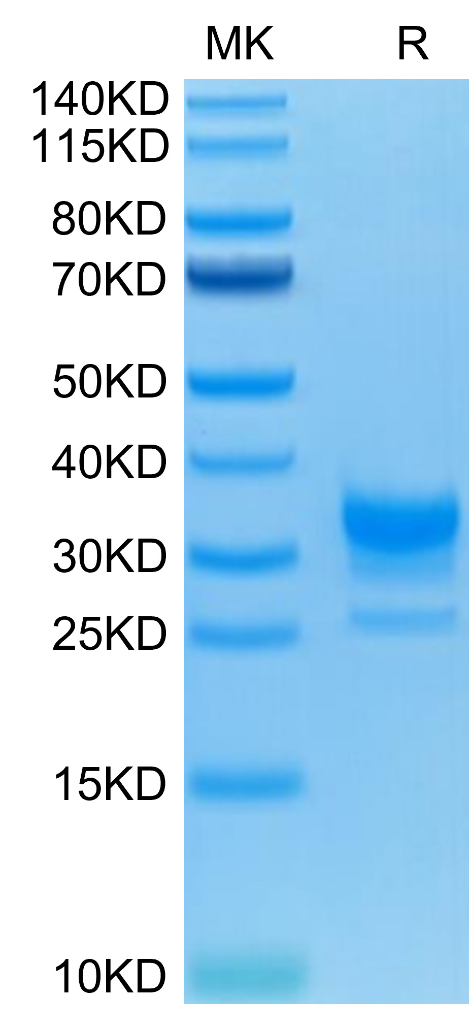 Recombinant Human Fc gamma RIIB/FCGR2B/CD32b Protein