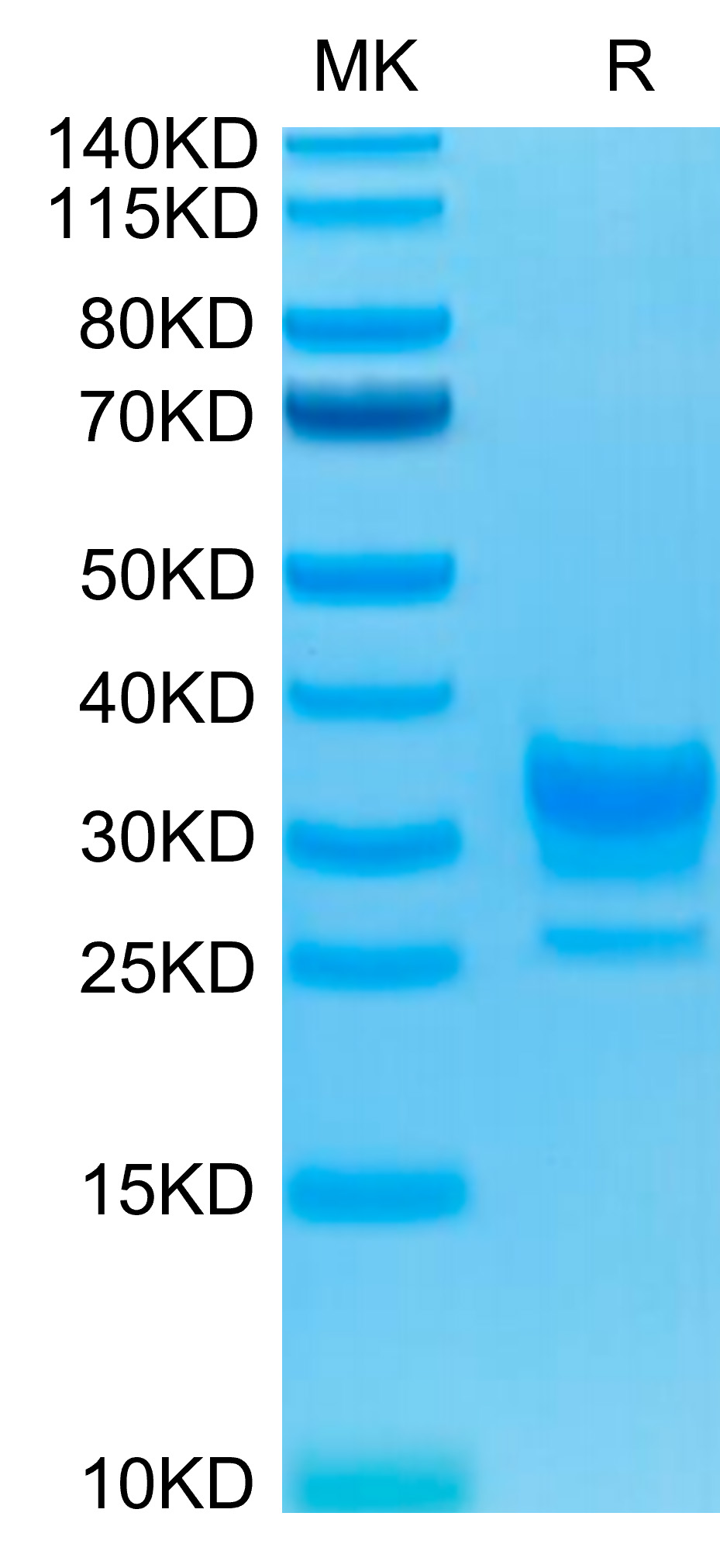 Biotinylated Recombinant Human Fc gamma RIIB/FCGR2B/CD32b Protein