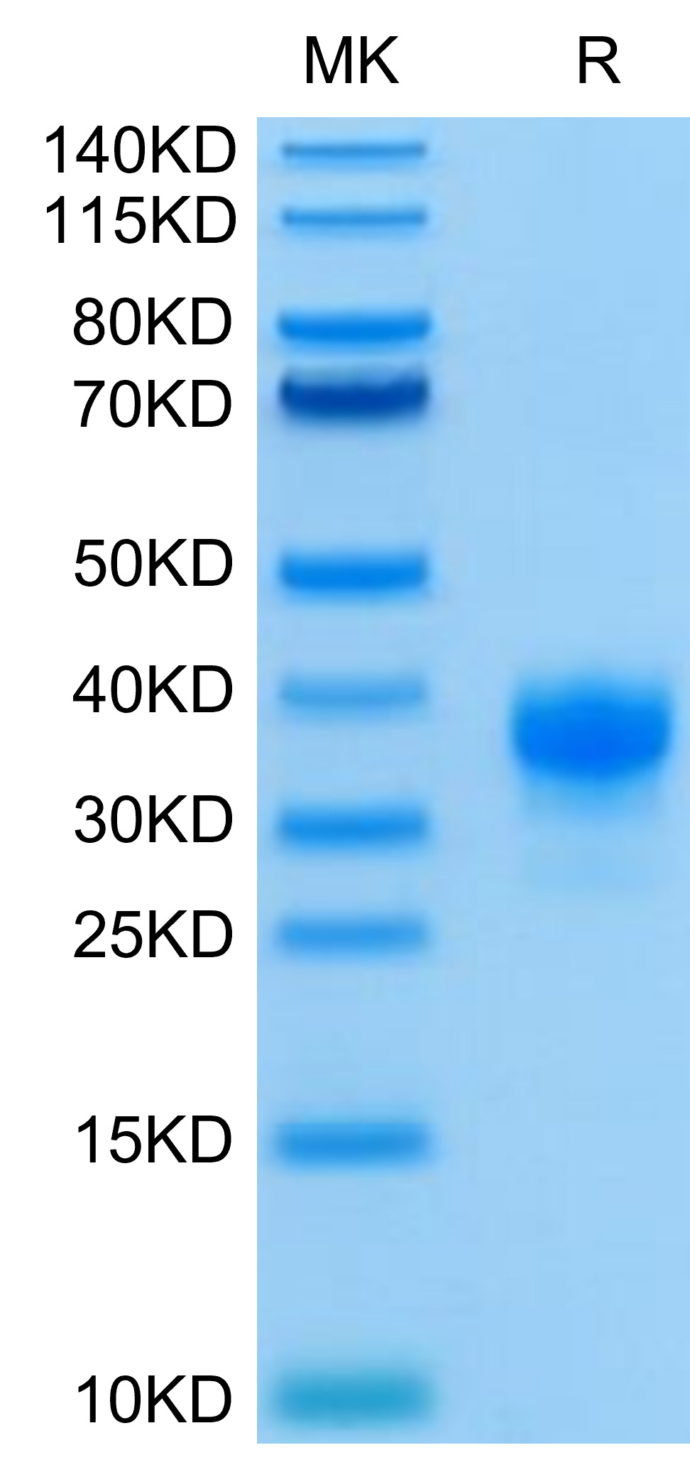 Recombinant Human Fc gamma RIIA/FCGR2A/CD32a (H167R) Protein