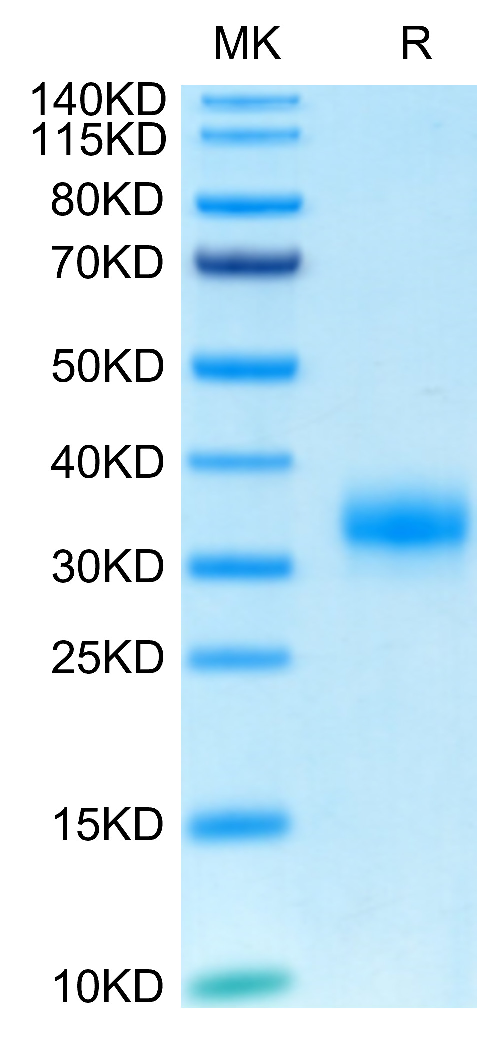 Biotinylated Recombinant Human Fc gamma RIIA/FCGR2A/CD32a (H167R) Protein