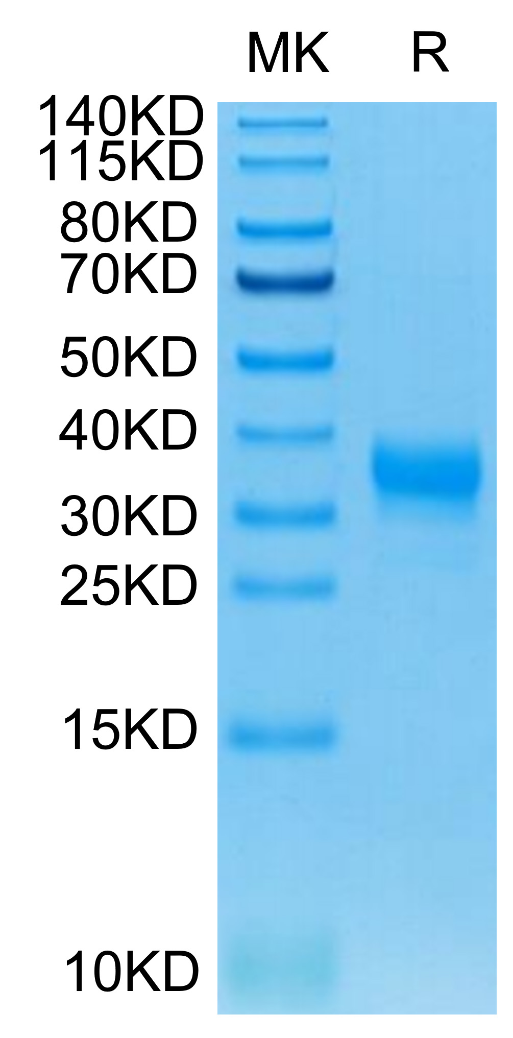 Recombinant Human Fc gamma RIIA/FCGR2A/CD32a Protein