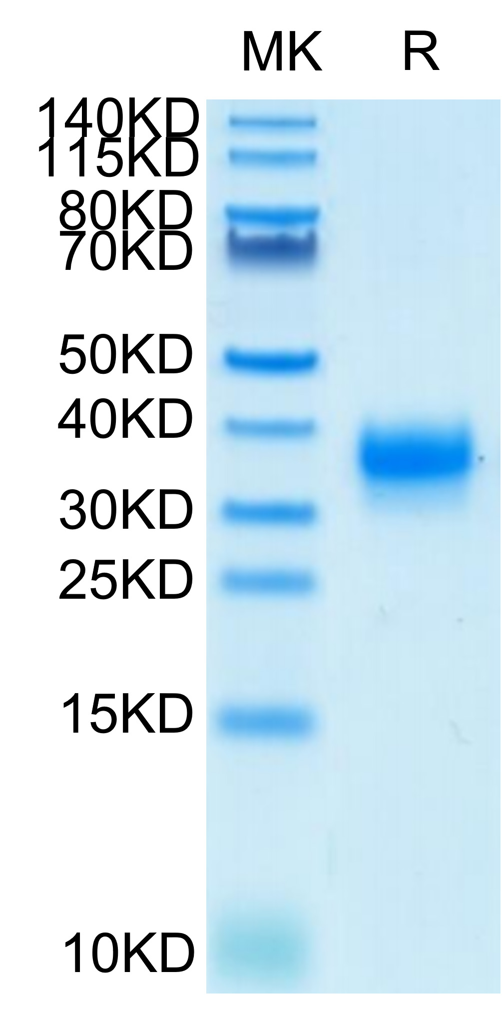 Biotinylated Recombinant Human Fc gamma RIIA/FCGR2A/CD32a Protein