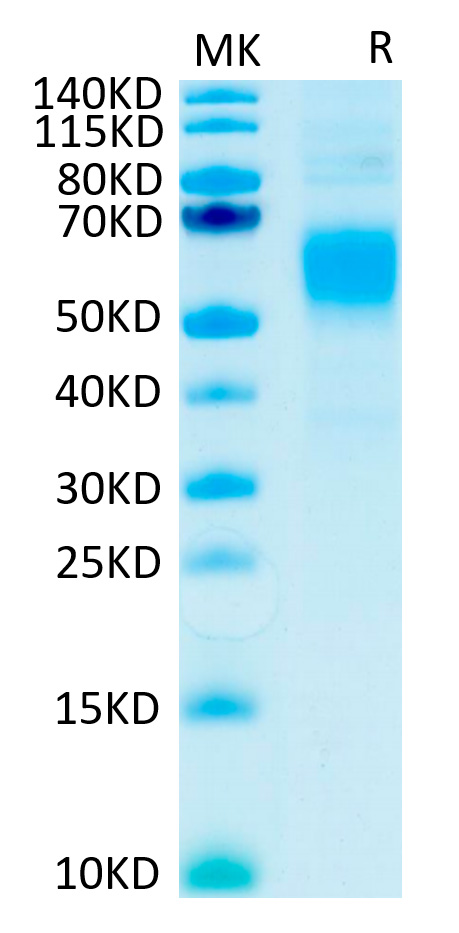 Recombinant Human Fc gamma RI/FCGR1/CD64 Protein