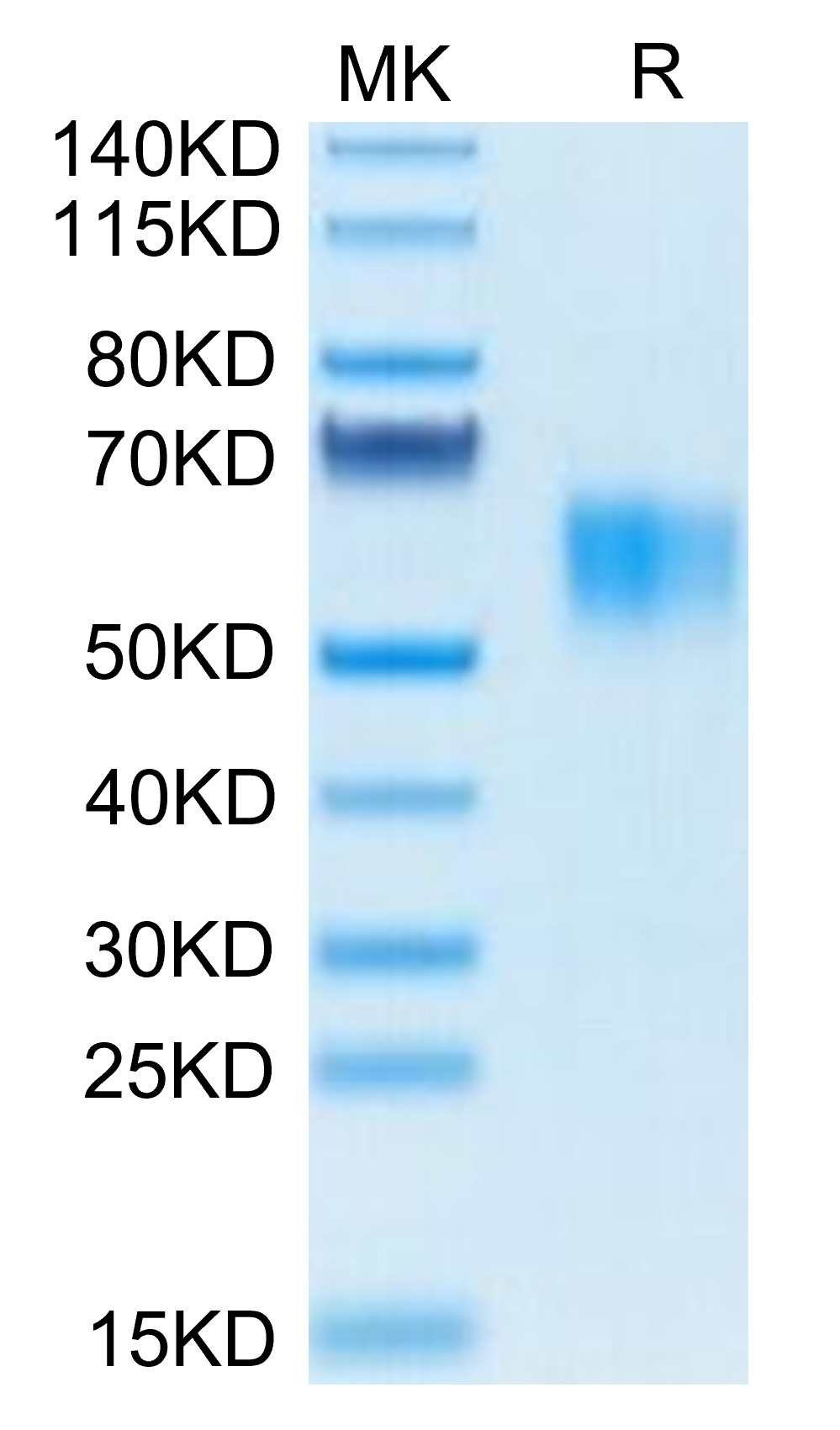 Biotinylated Recombinant Human Fc gamma RI/FCGR1/CD64 Protein