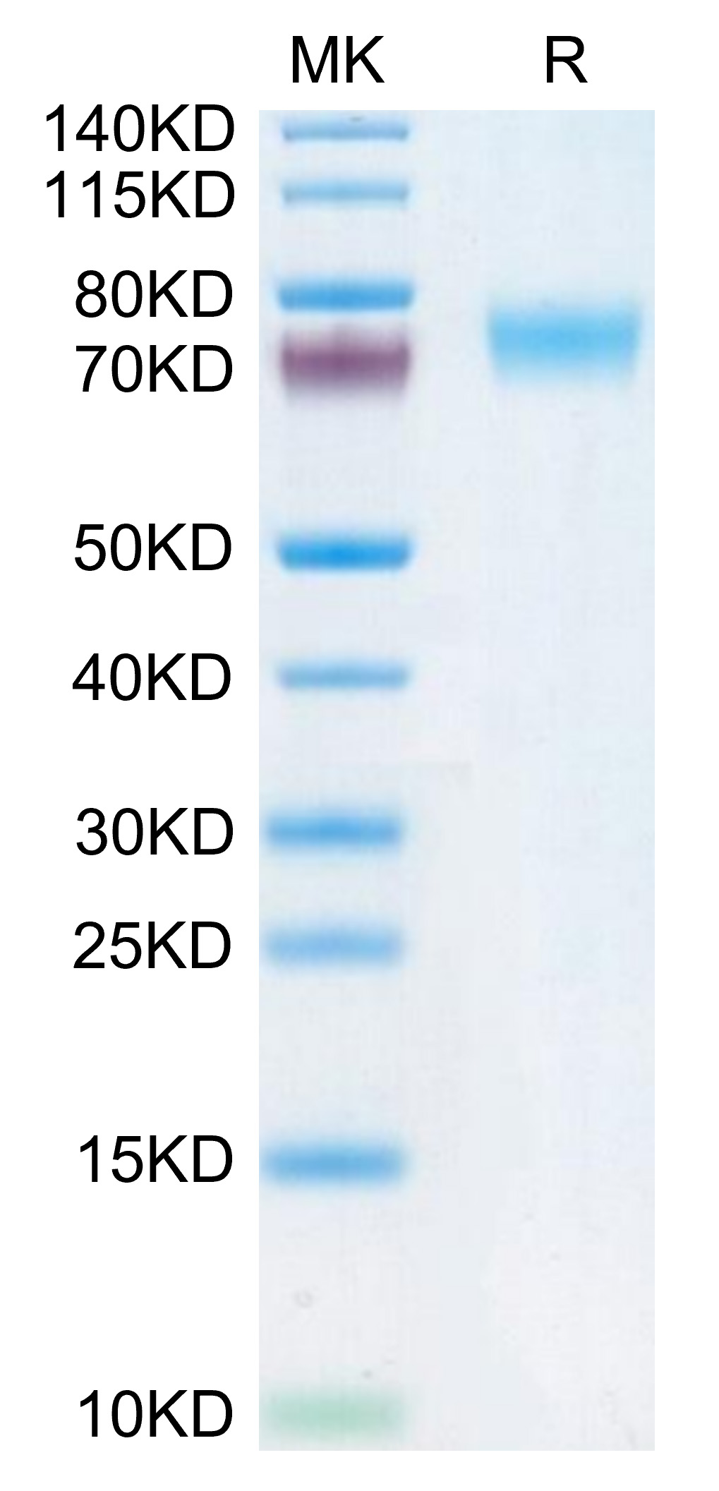 Recombinant Human Fc-epsilon RI-alpha/FCER1A Protein