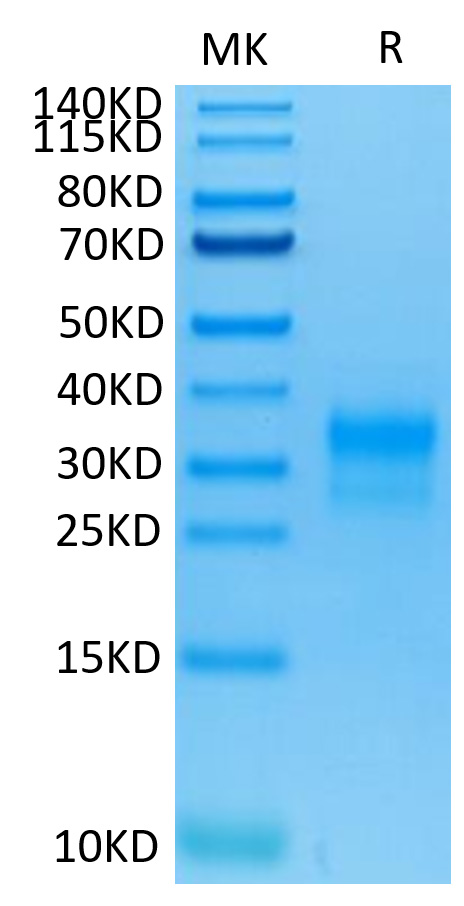 Recombinant Human ERBB2/HER2/CD340 (489-630) Protein