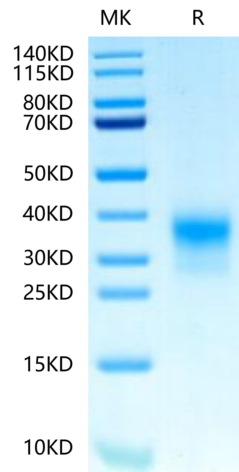 Biotinylated Recombinant Human ERBB2/HER2/CD340 (489-630) Protein