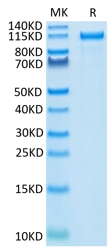 Recombinant Human ErbB-2/HER2/CD340 Protein