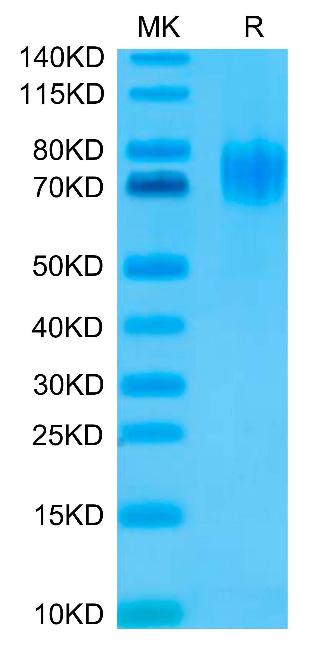 Recombinant Human HER1/ERBB1/EGFR (25-378) Protein