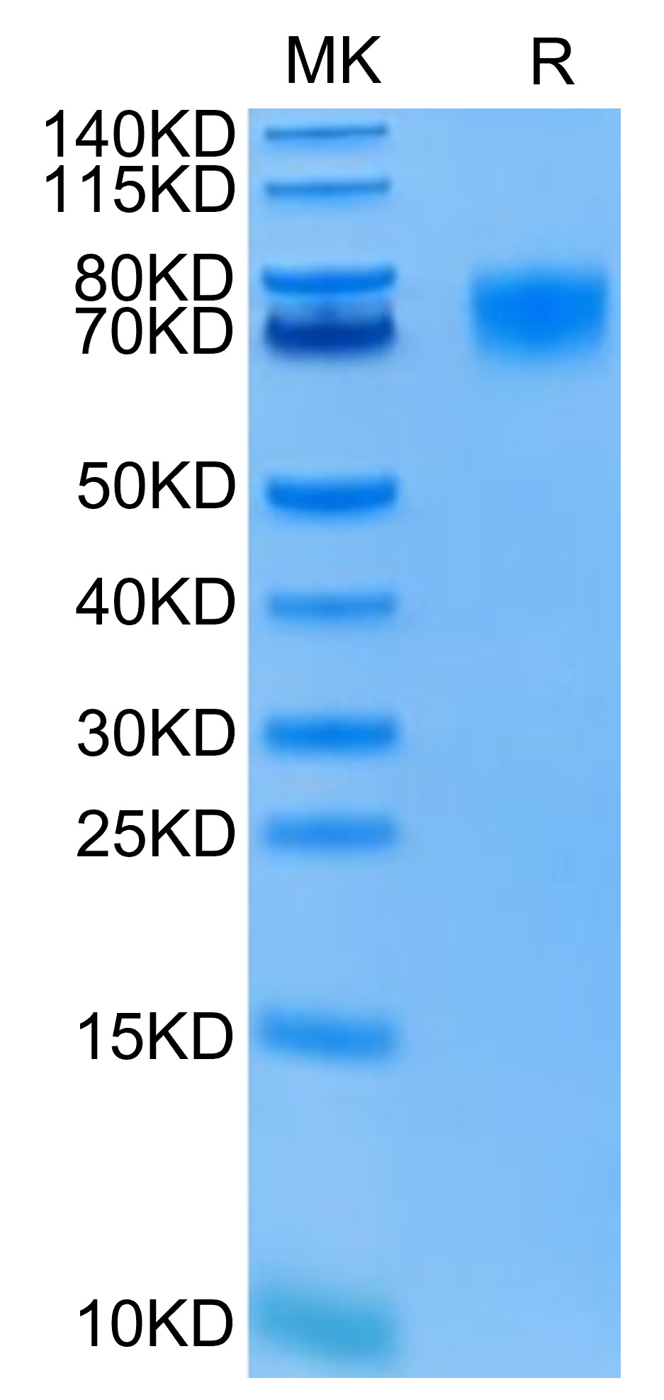 FITC-Labeled Recombinant Human HER1/ERBB1/EGFR (25-378) Protein