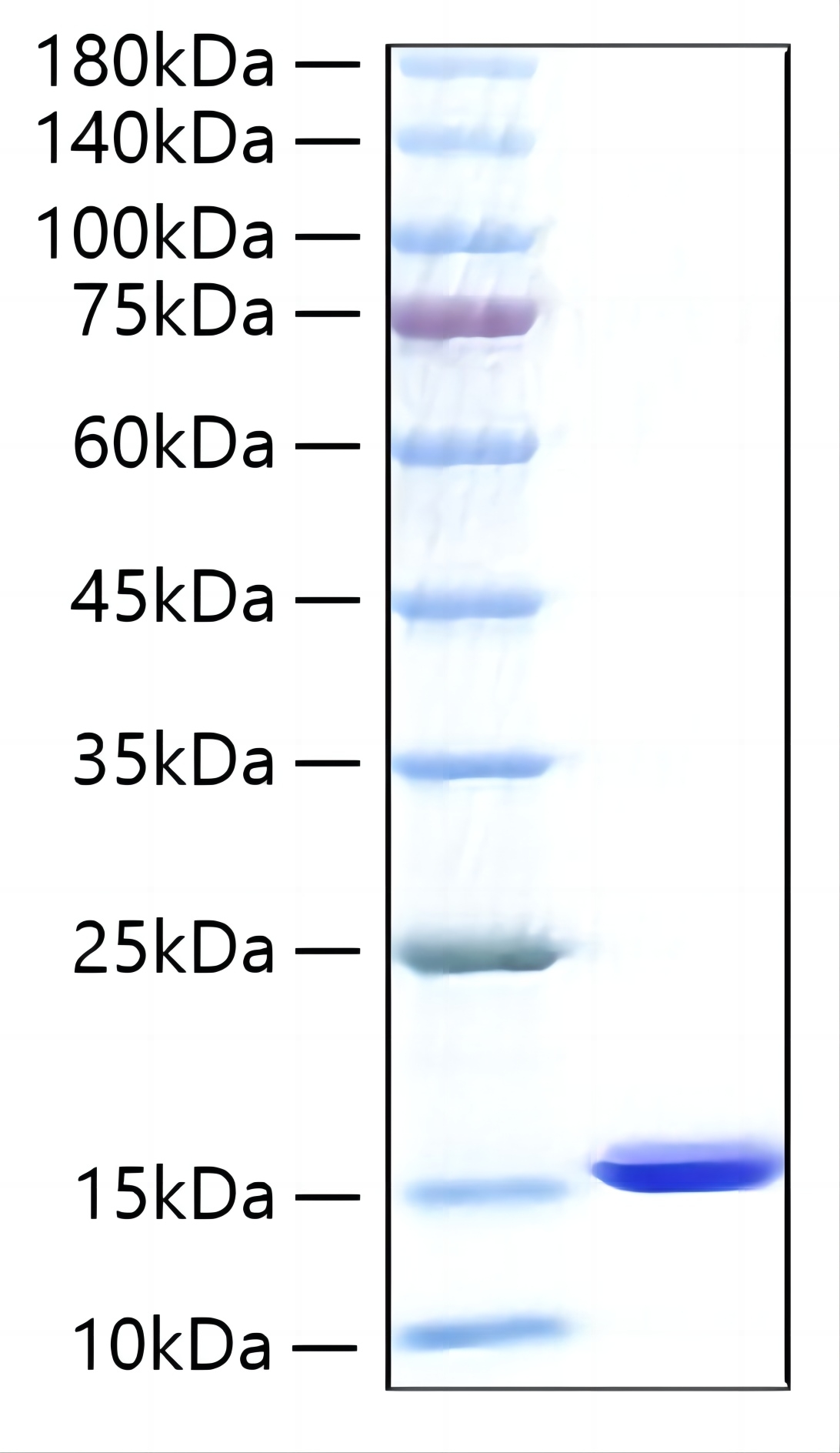 Recombinant Human FABP1/L-FABP Protein