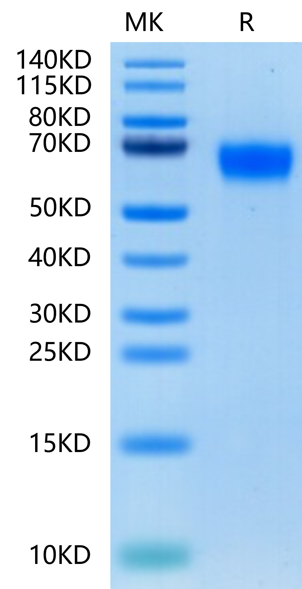 Recombinant Human CSF2RA/GM-CSF R alpha/CD116 Protein