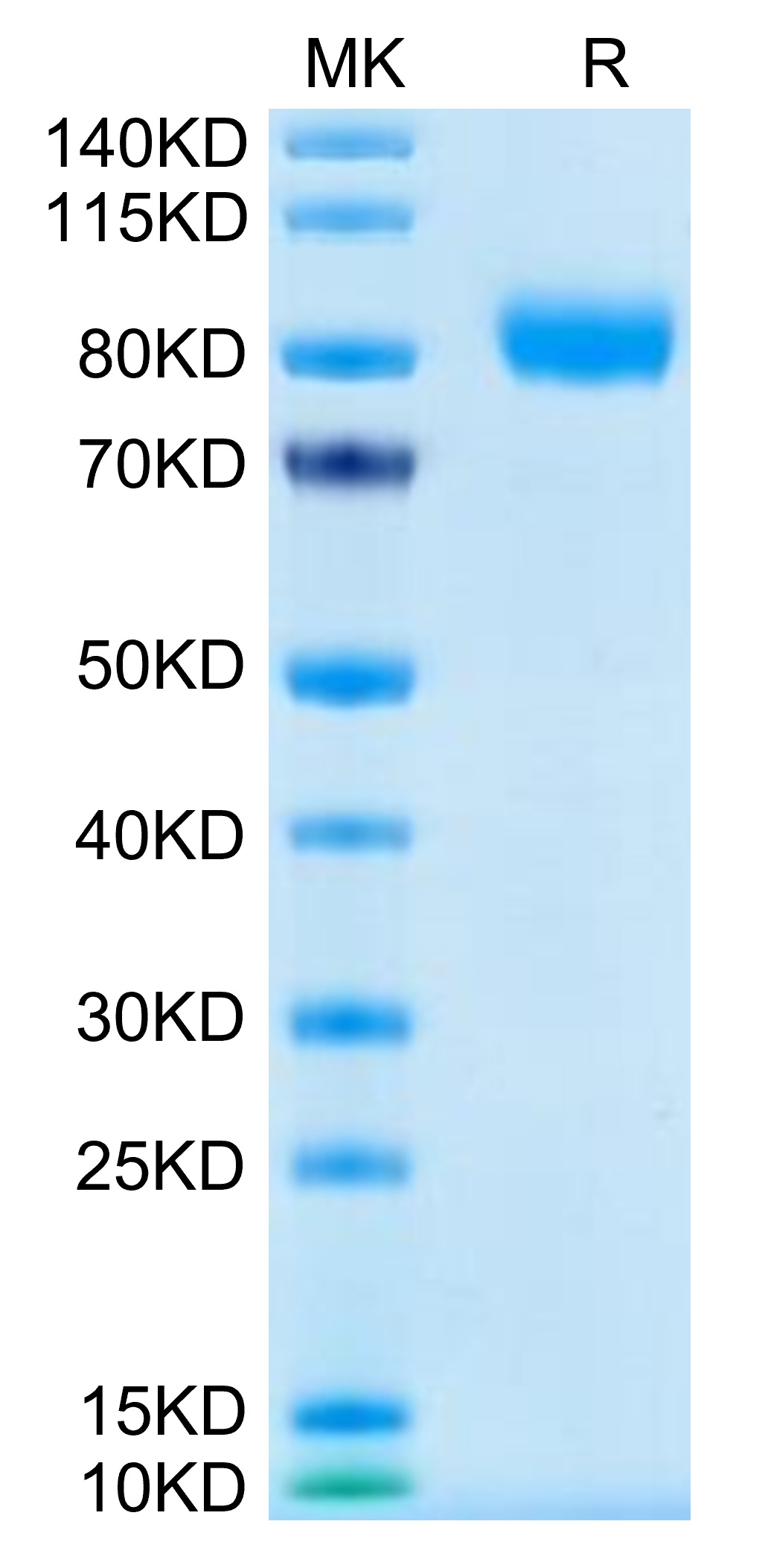 Recombinant Human CSF2RA/GM-CSF R alpha/CD116 Protein